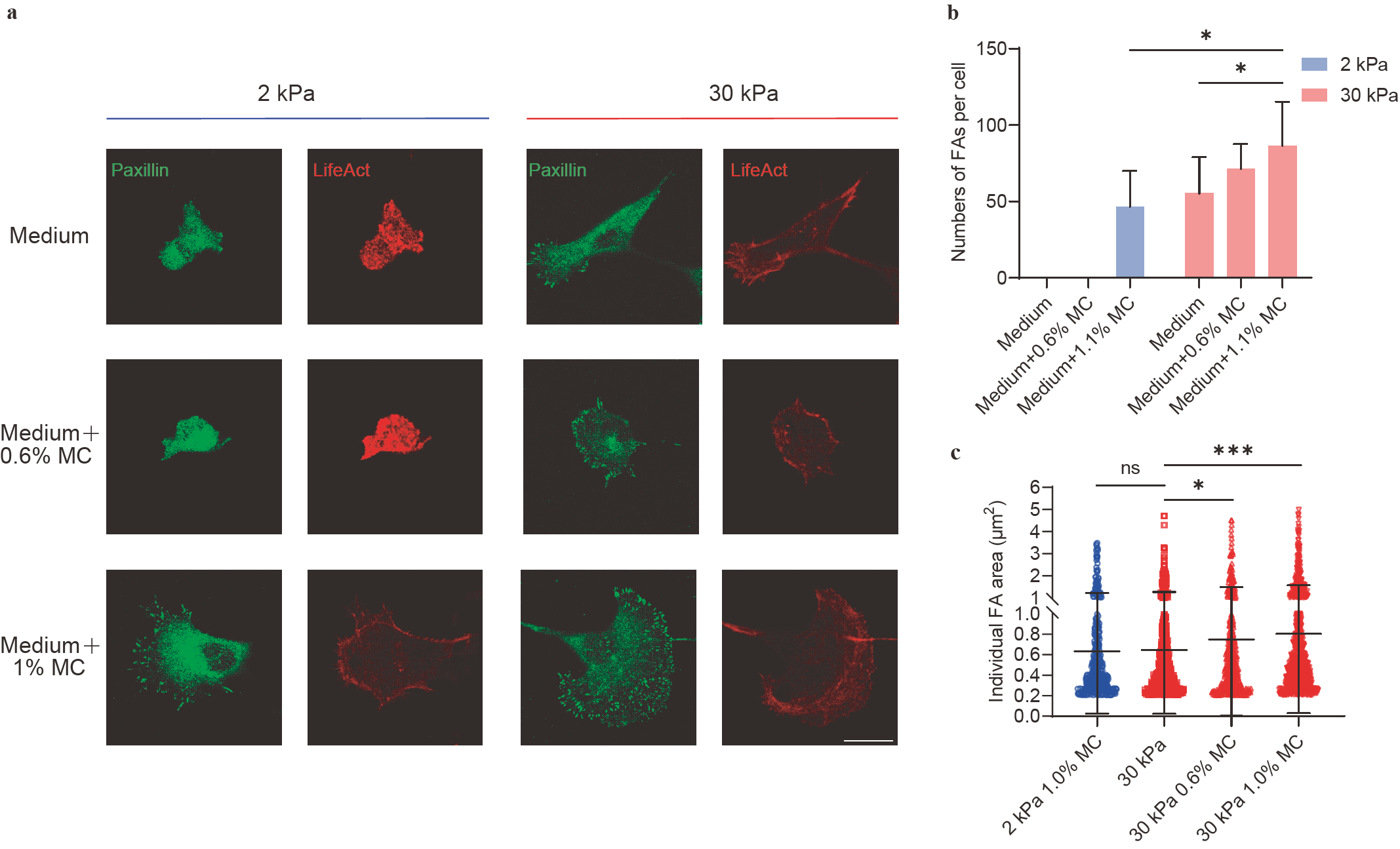 Enhancement effects of extracellular fluid viscosity and matrix ...