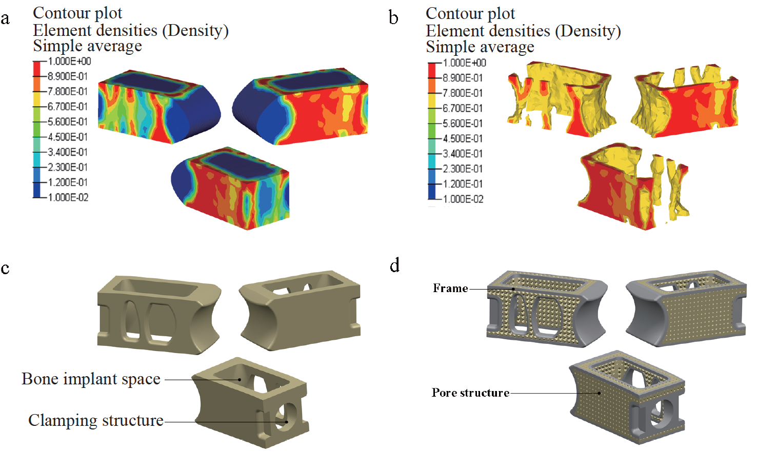 A newly designed personalized interbody fusion cage and its ...