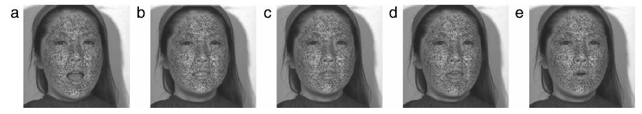 Visualizing surface strain distribution of facial skin using stereovision