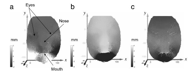 Visualizing surface strain distribution of facial skin using stereovision