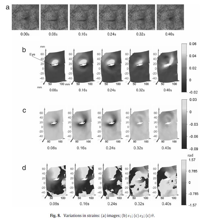 Visualizing surface strain distribution of facial skin using stereovision